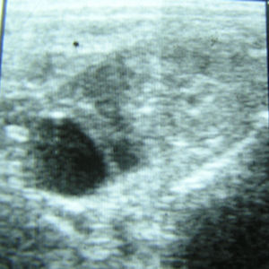 sonograf